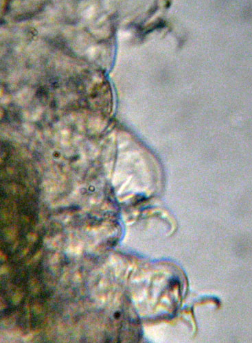 Tardigrado: probabile Macrobiotus richtersi